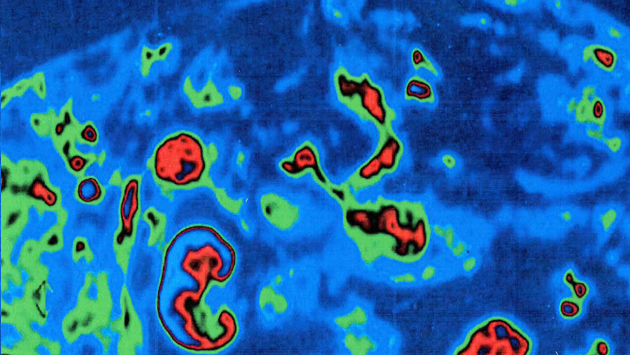 Ricerca scientifica - Fondazione Alessandra Bisceglia ViVa Ale ETS